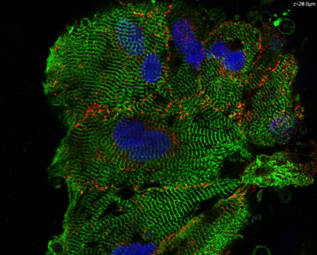 Fluoreszenz Aufnahme von Kardiomyozyten Sphaeroid